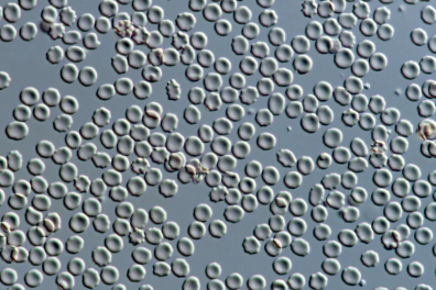 Hématies A et sérum anti-B (absence d'agglutination) x160